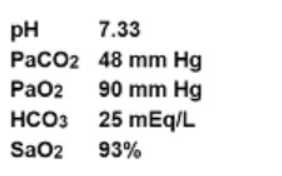 CCRN practice exam questions